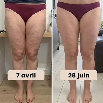 Huile de massage anti-cellulite