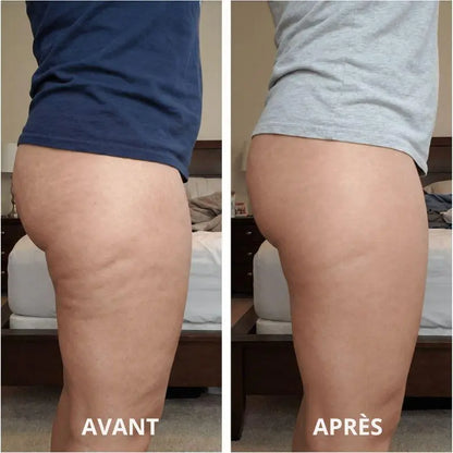 Huile de massage anti-cellulite